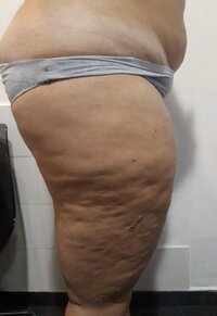 culona (2).jpg